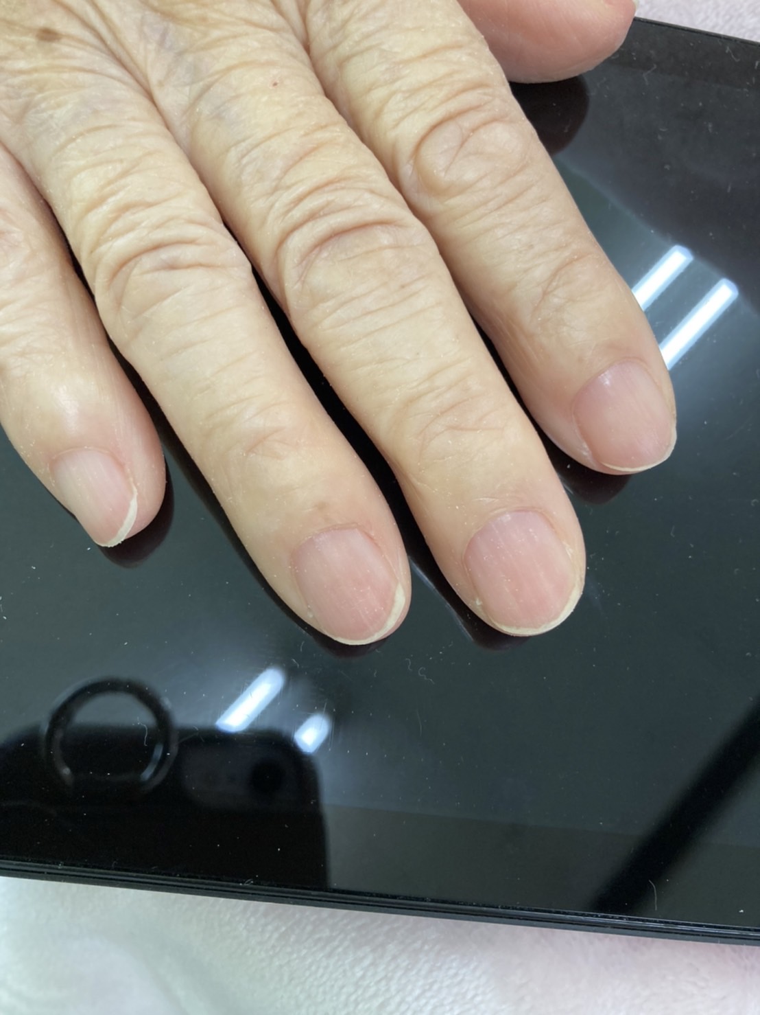 記事 巻き爪処置の嬉しい副産物のアイキャッチ画像