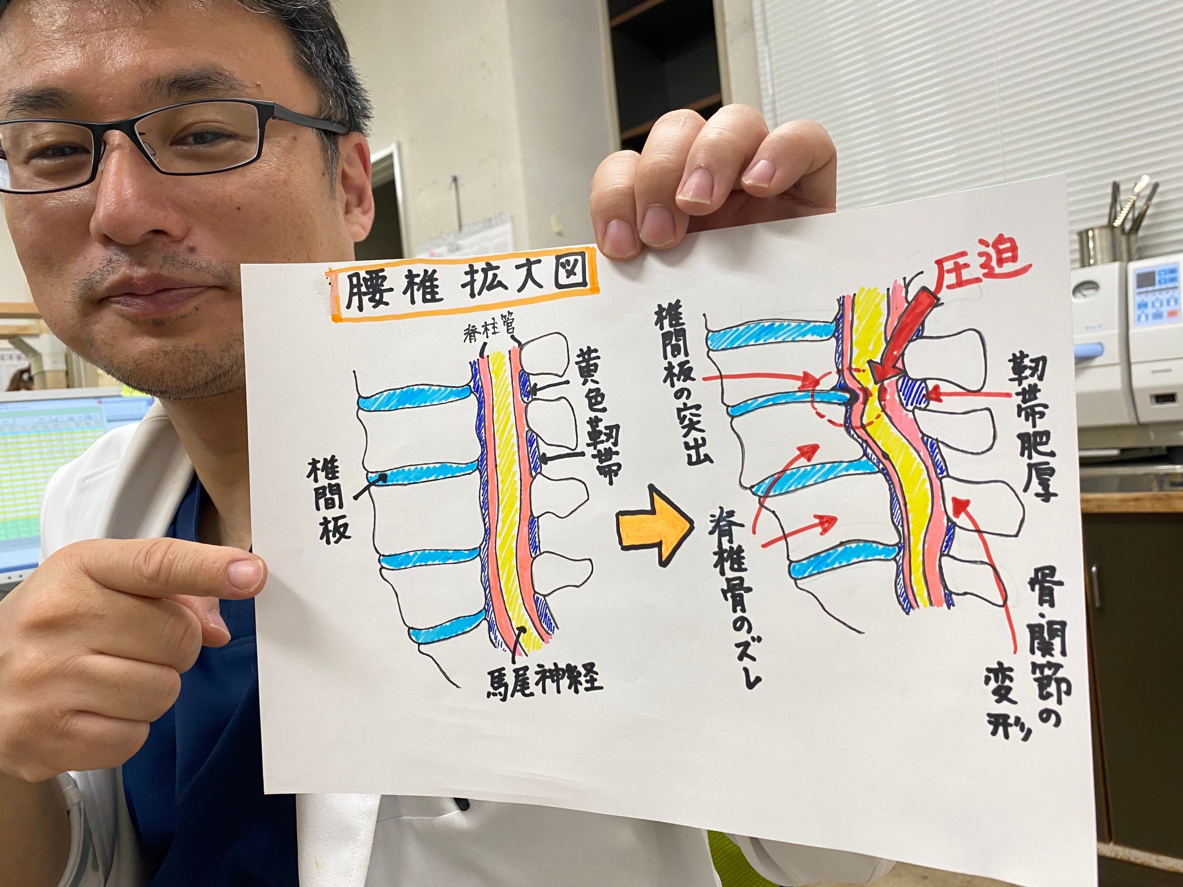 記事 変形性腰椎症って？のアイキャッチ画像